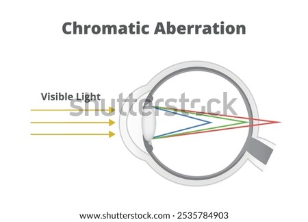 Vector illustration of chromatic aberration or refraction of light in the human eye. Shorter wavelength rays are focused in front of the retina, longer wavelength rays are focused behind the retina. 