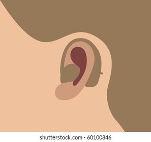Vector illustration of a close-up of a man ear with a behind-the-ear-hearing device