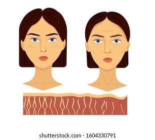 Vector illustration comparison of two female face young and aged skin fiber epidermis with collagen. Medical and cosmetology graphic design isolated on white background