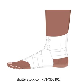 Vector illustration. Correct way to wrap African American human ankle by flexible elastic supportive orthopedic bandage for sprain, strain. Lateral view.  For advertising, medical publications. EPS 8.