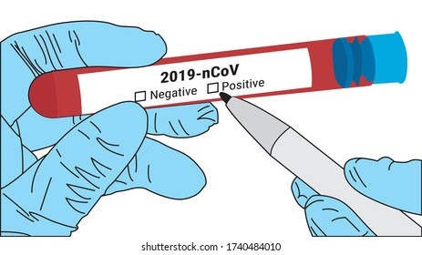 Ilustración vectorial Covid-19 La prueba rápida es un método inicial de detección de anticuerpos, a saber IgM e IgG, producidos por el organismo para combatir el virus Corona.