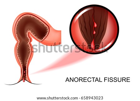 Think, Anus free pictures have appeared Remarkable topic Anus free pictures think