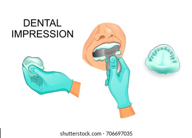 vector illustration of a dental cast of human teeth
