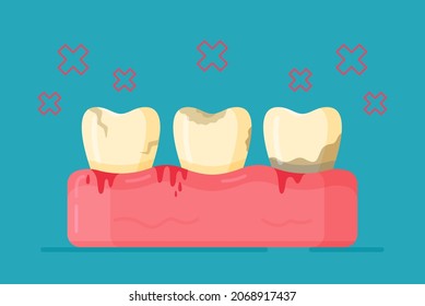 Vector illustration of dental diseases. Not hygienic. Going to the dentist.  