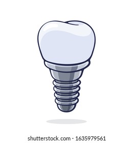 Vector illustration. Dental implant of human tooth. Fixture prothesis in dentistry. Symbol of somatology and oral hygiene. Graphic design with contour. Isolated on white background
