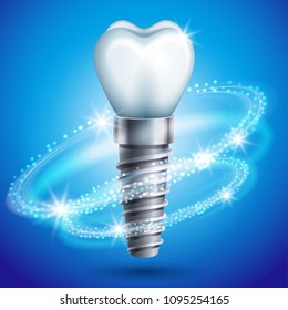 Vector illustration - dental implant icon