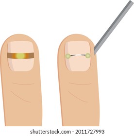 Vector illustration for design of podology