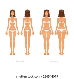 Vector illustration of different  body types, before and after plastic surgery.