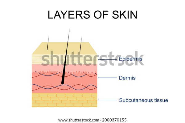 Vector Illustration Different Skin Layers Stock Vector (Royalty Free ...