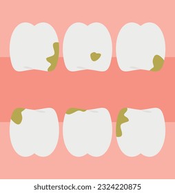 Vector illustration of dirty teeth and teeth. Oral hygiene.