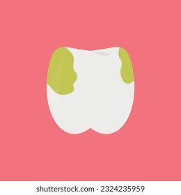 Vector illustration of a dirty tooth with caries. Dental diseases and oral hygiene.