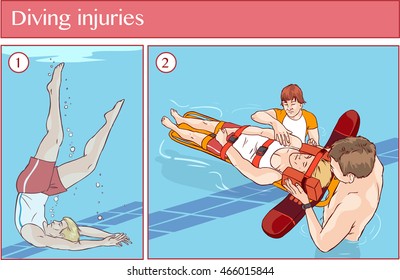 Vector illustration of a Diving injuries 