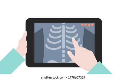 vector illustration of a Doctor holding a tablet computer with a lung x-ray. Telemedicine, telemedicine flat illustration concept. Hands, chest x-ray. Vector design element for digital online medicine