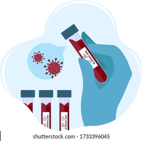 Vector Illustration | Doctor's Hands holding a positive blood test tubes for Covid-19  Coronavirus