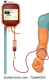 vector illustration of a donor blood transfusion to the patient