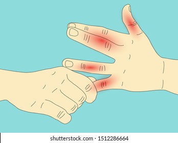 Vector illustration doodle drawing of body people with hand pain, palm, bone of finger and numbness in fingertips. Rheumatoid arthritis.