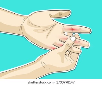 Vector illustration doodle drawing of body people with hand injury, palm, bone joint pain finger pain and numbness in fingertips. Rheumatoid arthritis.