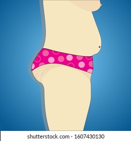 Vector illustration doodle drawing sketch of people with overweight and has fat belly and broken skin.