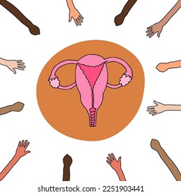
Ilustración vectorial en el concepto de doodle sobre el tema de la justicia reproductiva.
En el centro del órgano reproductivo femenino, muchas manos se acercan a él y quieren agarrarse.