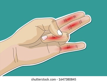 vector illustration drawing of people with hand ache and finger pain.