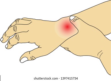 Vector illustration drawing of people with wrist pain