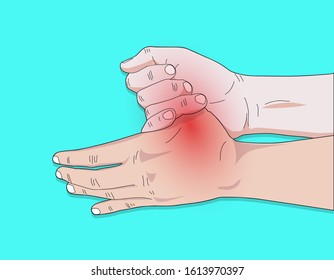 Vector Illustration Drawing Sketch With Thumb Sore, Trigger Finger, Hand Pain And Numbness.