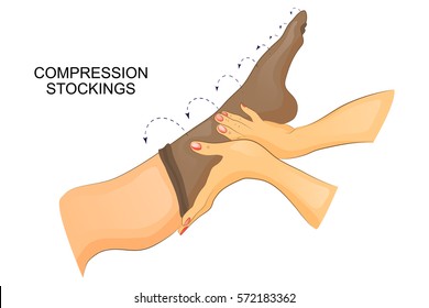 vector illustration of dressing compression stocking on the leg.
