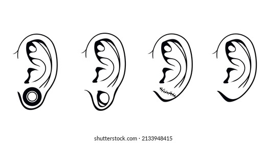 Ilustración vectorial de la oreja con túnel, perforación estirada. Earlobe después de la reparación del túnel de la carne aislado en blanco