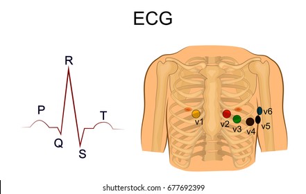 988 Ekg lead Images, Stock Photos & Vectors | Shutterstock