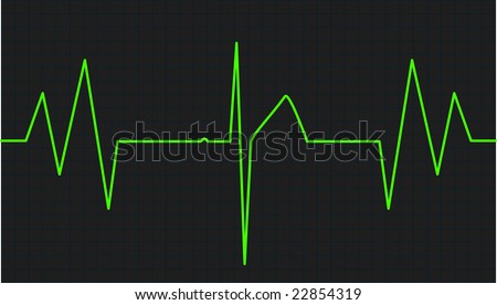 Vector illustration of electrocardiogram's track