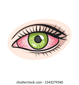 Vector illustration of eye and cataract symbol. Web element of eye and eyesight stock vector illustration.