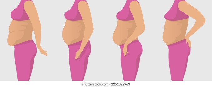 Vector illustration of fat women with different types of belly