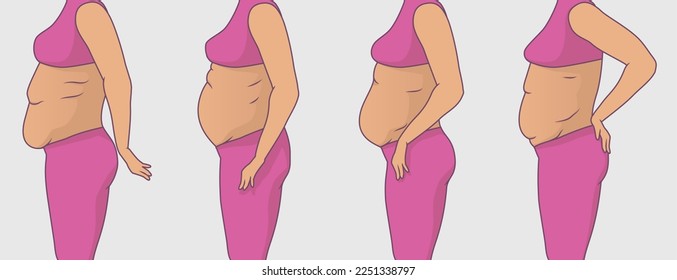 Vector illustration of fat women with different types of belly with contour line