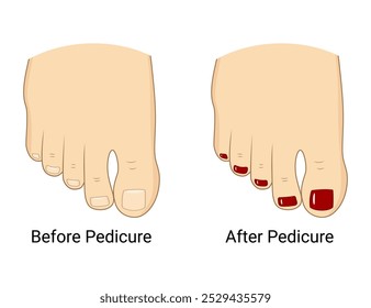 Ilustración vectorial de pies con esmalte de uñas rojo en un pie y uñas naturales en el otro. Perfecto para temas como pedicura, cuidado de uñas, tratamiento de belleza y cuidado de los pies. Antes y después.