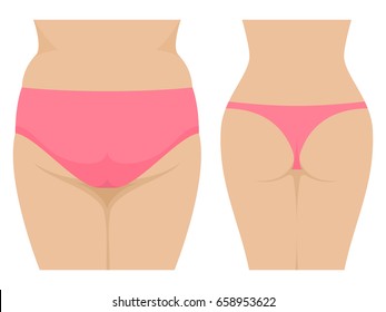 Vector illustration of a female fat and thin ass. Isolated on white background. Fatty ass before and after losing weight. Back view. Flat style.