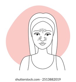 Ilustração vetorial de um retrato feminino com blackheads e um fundo rosa claro.