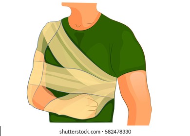 vector illustration of fixation bandages at fractur