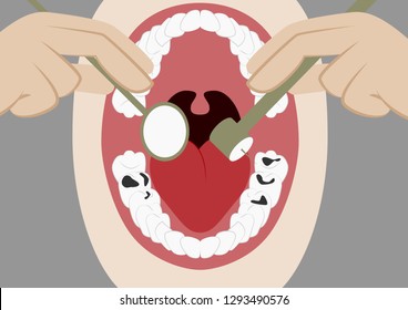 Vector illustration in flat design oral cavity and dental instruments