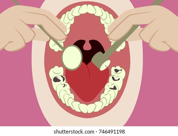 Vector illustration in flat design oral cavity and dental instruments