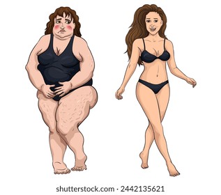 Ilustración vectorial en estilo de dibujos animados modernos planos que representan problemas de obesidad. Comparando dos tipos de cuerpo femenino. Ilustración de adelgazamiento y pérdida de peso