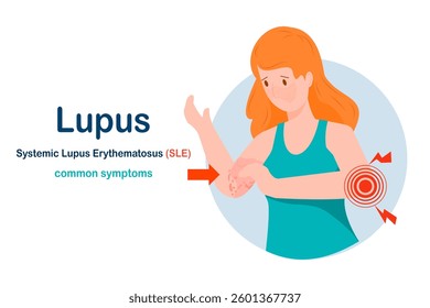 Vector illustration in flat style.common symptoms of Lupus,concept of health care and medical.