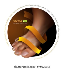 Vector illustration of foot fungus. Human foot with golden ribbon. Design template for advertisement layout