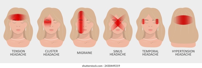 Vector illustration of a girl having a headache. Localization and types of headaches. Neurology and medicine.