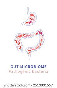 Ilustração vetorial do microbioma intestinal mostrando bactérias patogênicas no sistema digestivo.