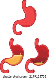 Vector Illustration of Gut split section