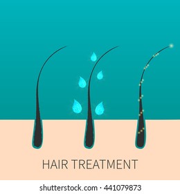 Vector Illustration Of Hair Follicles Before And After Treatment. Transition From Bad Damaged Hair To Healthy One. Beauty And Strengthening Concept.