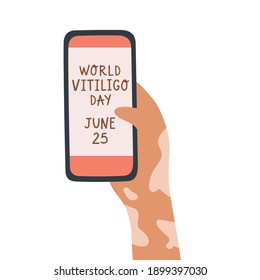 Vector illustration of hand with vitiligo skin disease holding phone. Concept of World Vitiligo Day June 25. Acceptance of self love. For blog, articles, banner, design