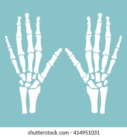 Vector illustration hands bones. Orthopedic human hand skeleton icon. Diagnostic center. Pair of human hands