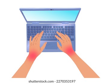 Ilustración vectorial de las manos con síndrome del túnel carpiano utilizando el teclado de ordenador y portátil