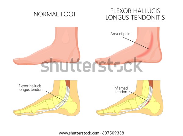Vector Illustration Healthy Human Foot Medial Stock
